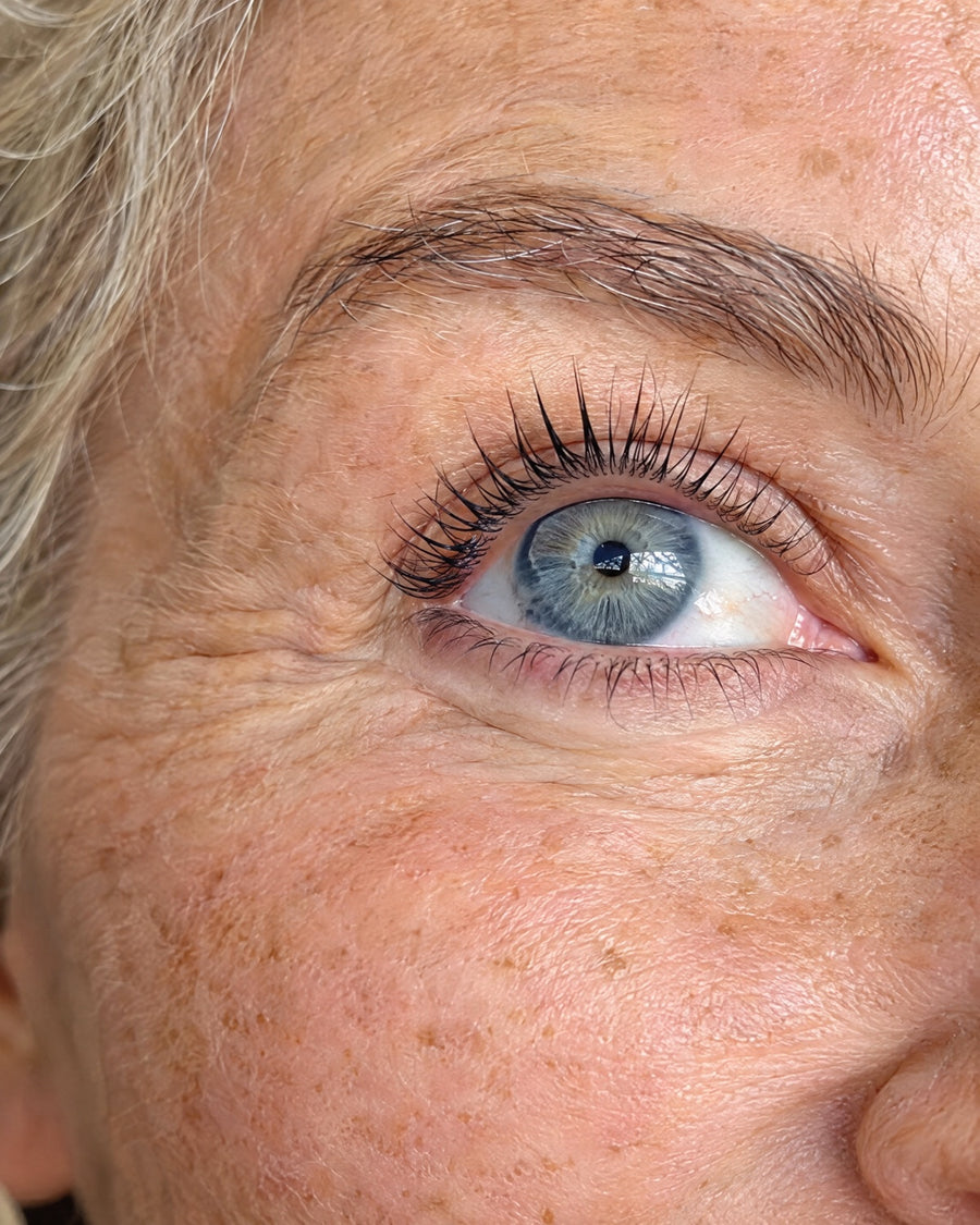 A Flexible Cast Keeps Eyes Looking Open